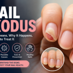 What It Means Why It Happens and What Your Nails May Be Telling You